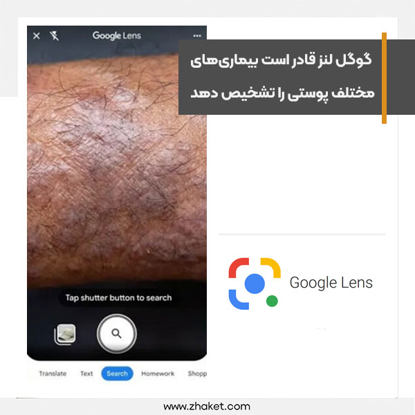 Google Lens is able to diagnose various skin diseases